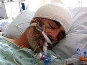 [ in hospital pic ]