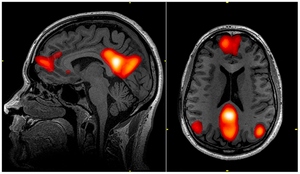 <b>Default mode network pic</b>
