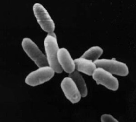 [ halobacteria picture ]